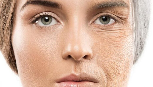 اگر روی صورت‌تان چین و چروک‌ دارید در معرض این ۶ بیماری هستید