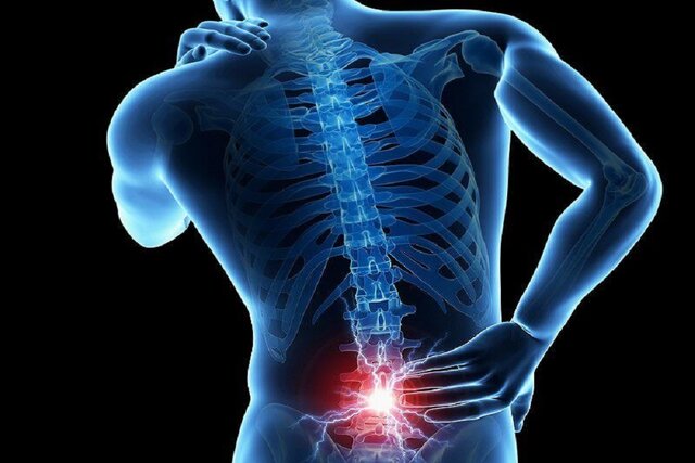 امید تازه برای درمان کمردردهای مزمن و ترمیم دیسک بین‌مهره‌ای